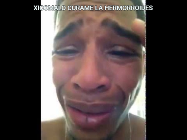 XICOMALO CURAME LA HERMORROIDES 